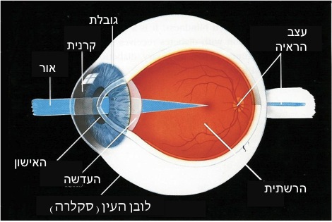 ניתוחי קטרקט שאלות ותשובות - ד
